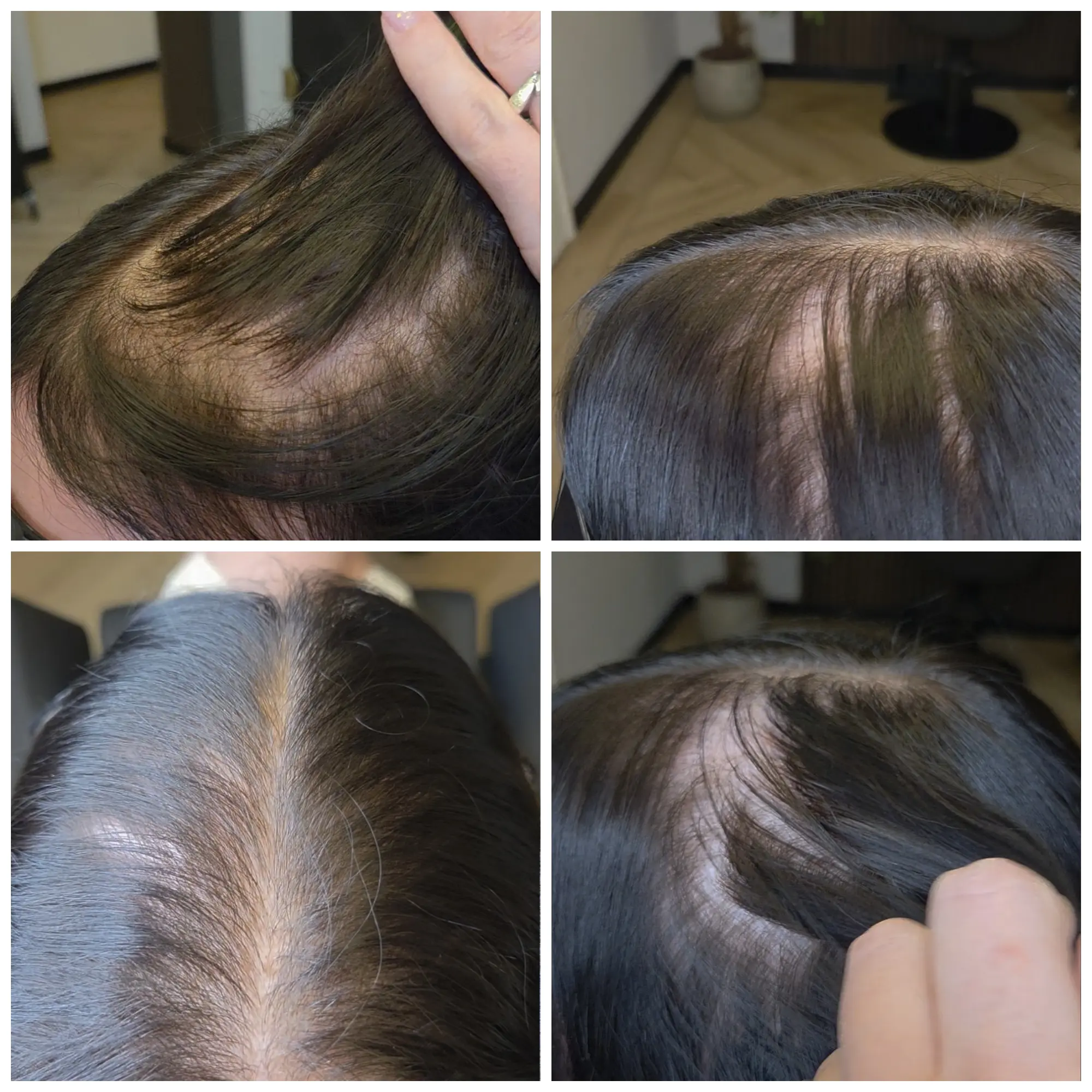 dun haar meshless integration